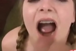 chubby teen braces first audition